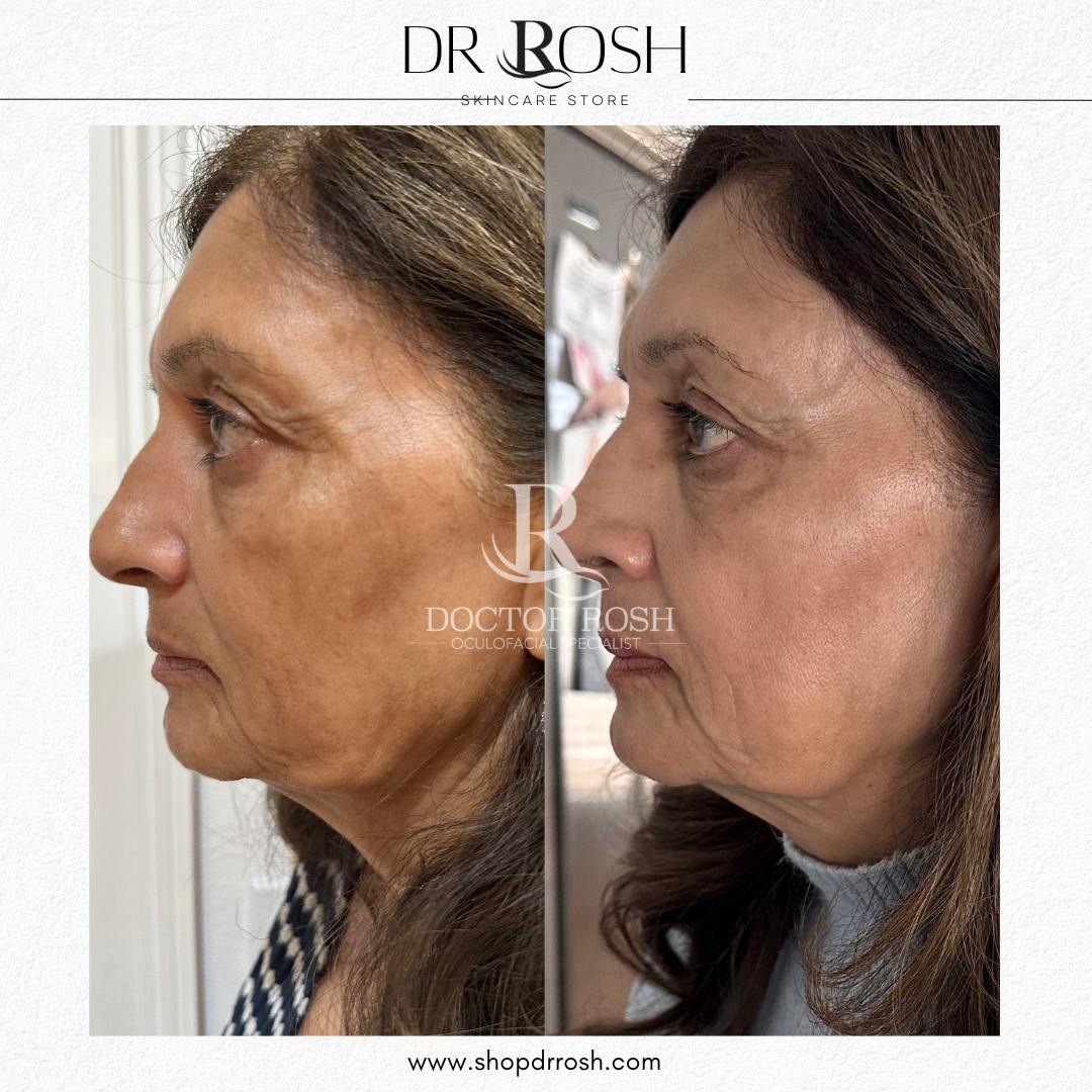 Signature Brightening Pads